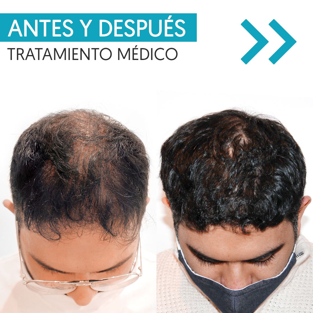 Karlexis León Montilla-15