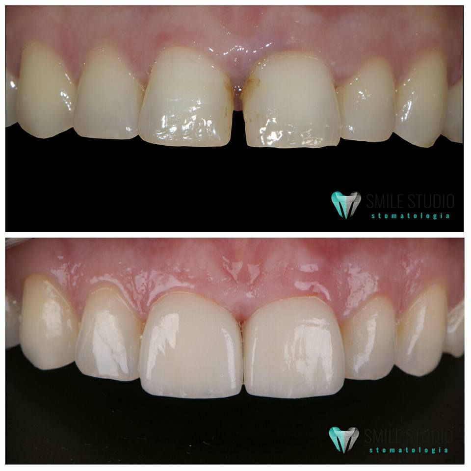 Michał Jankowski-19