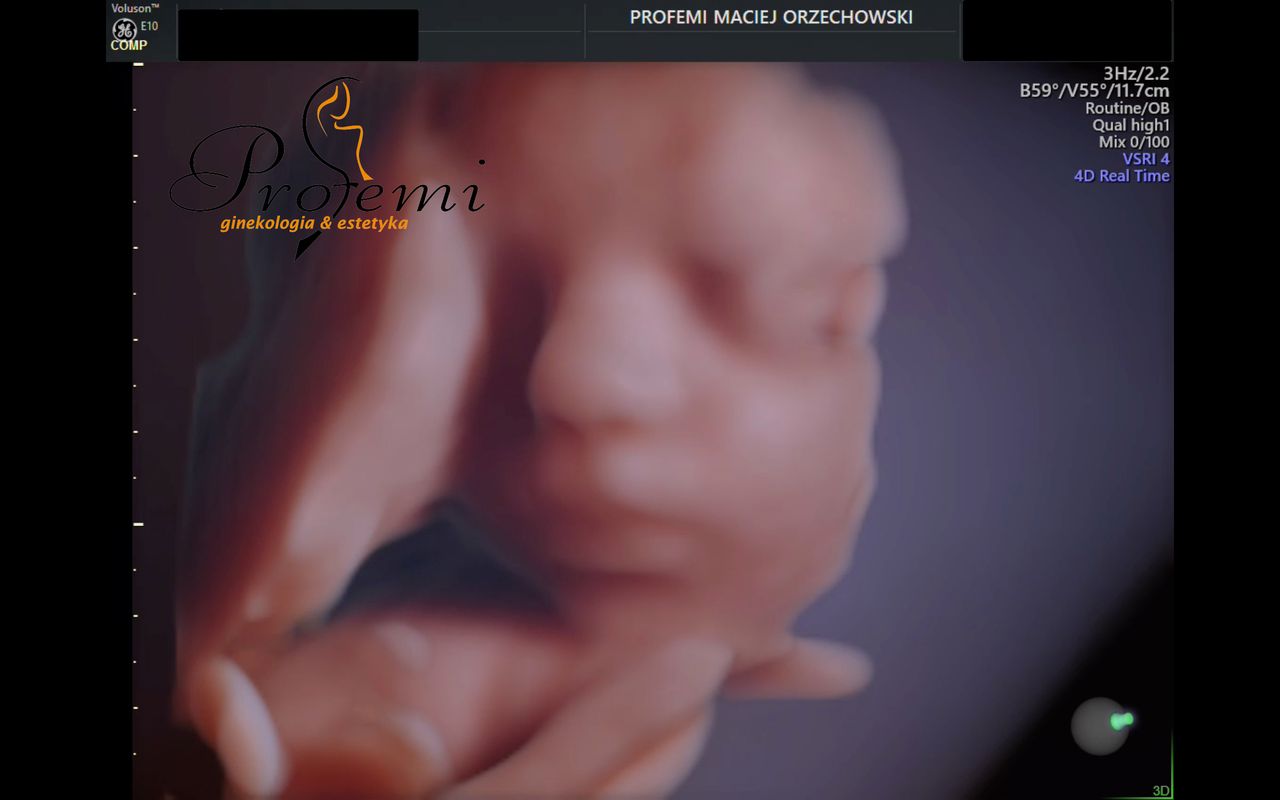 Maciej Orzechowski-25