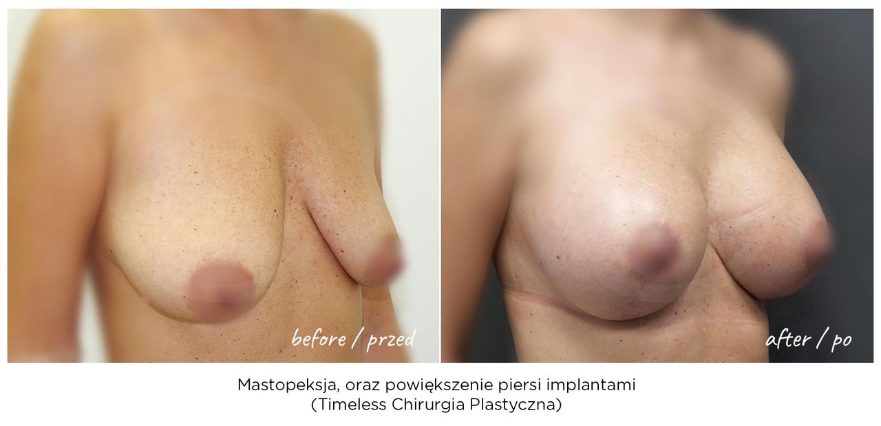 Janusz Jaworowski-42