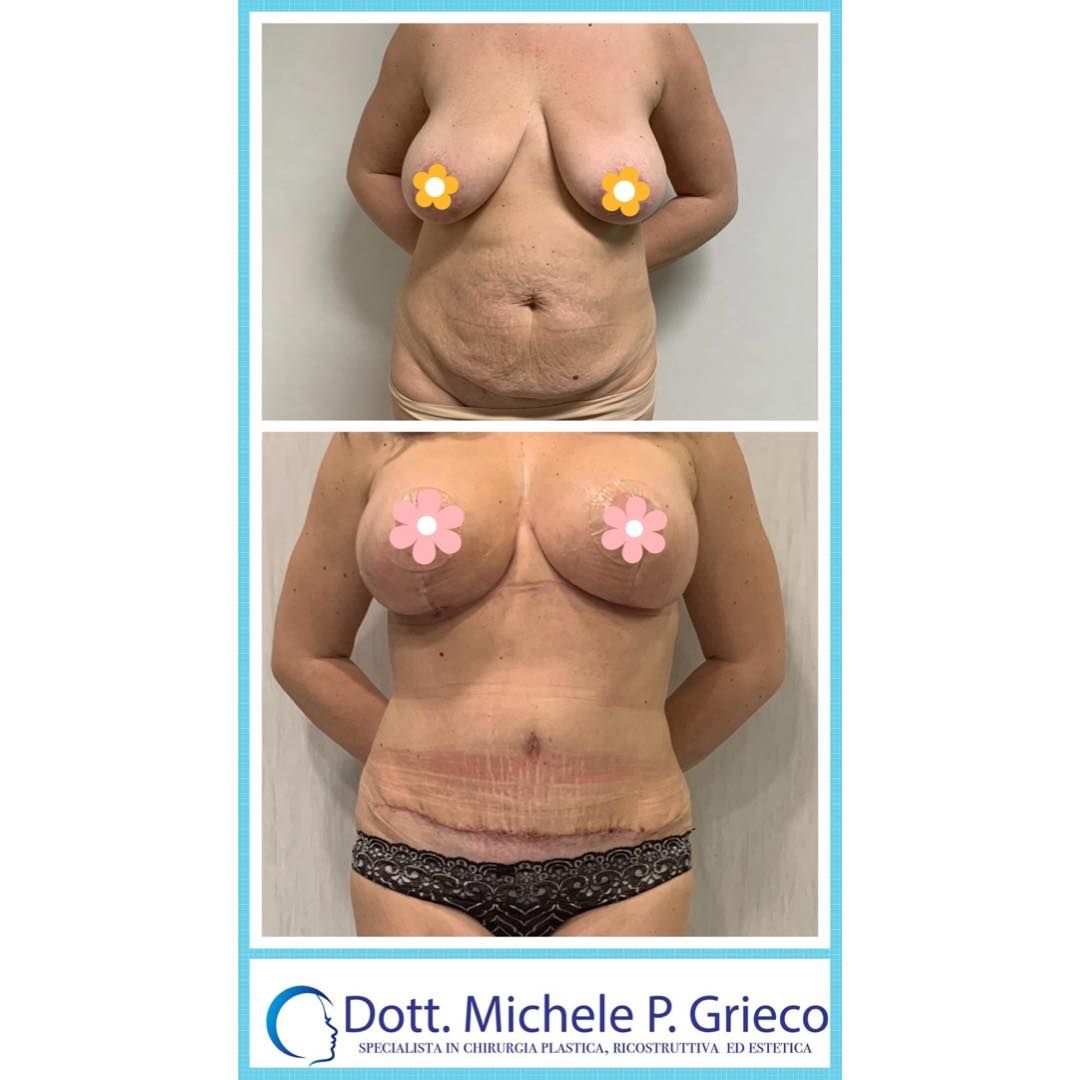 Michele P. Grieco-22