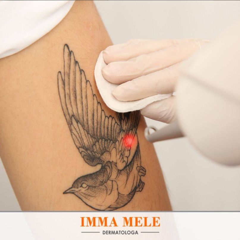 Imma Mele-3