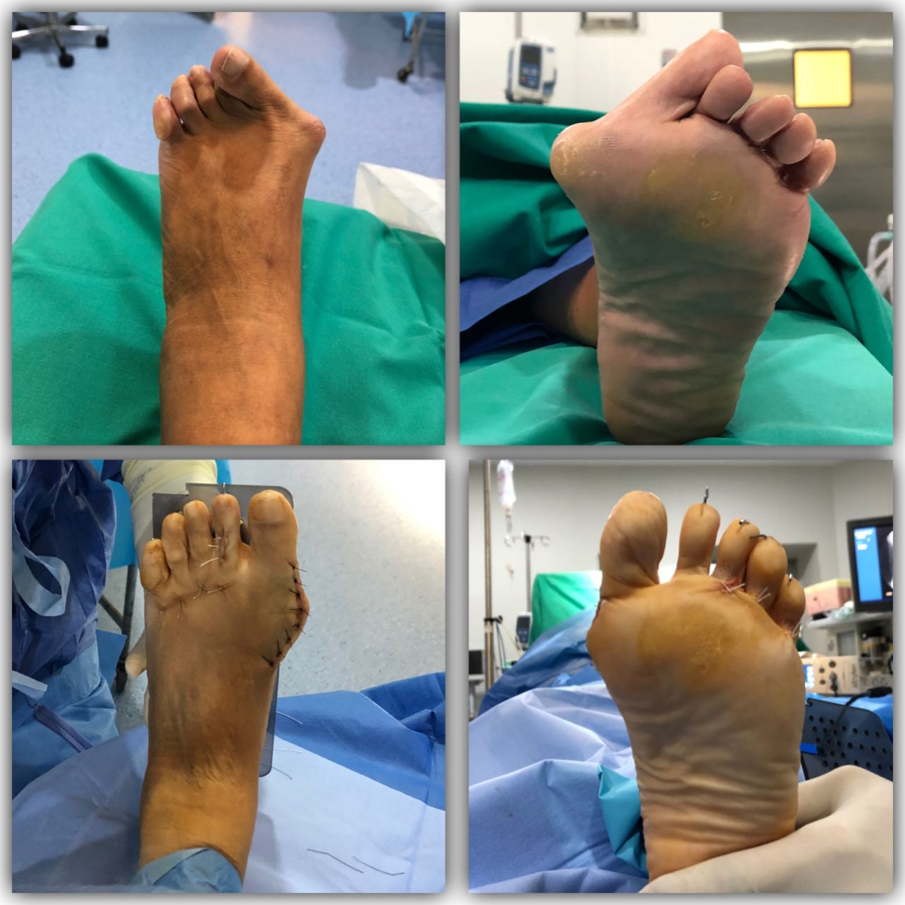 Fco Javier Carrillo Piñero-4