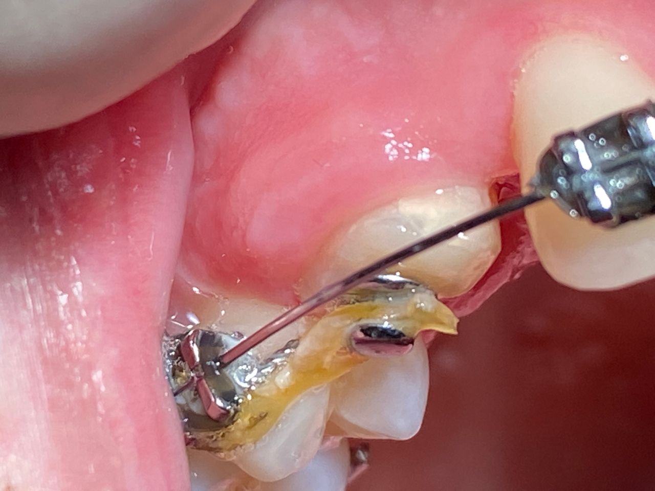 Luigi Giuseppe Romano-5