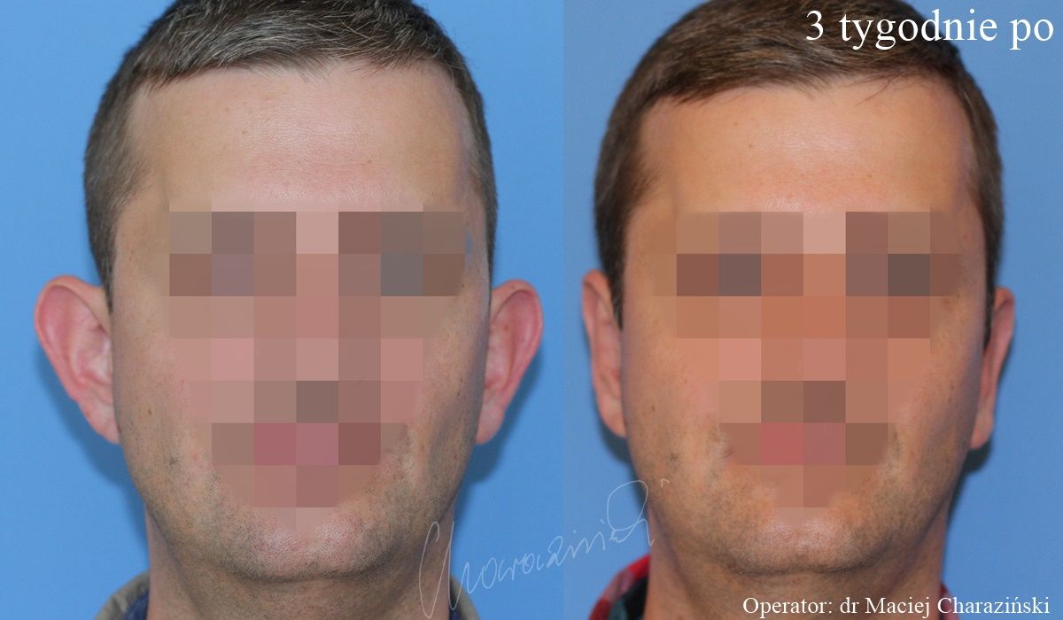 Maciej Charaziński-134