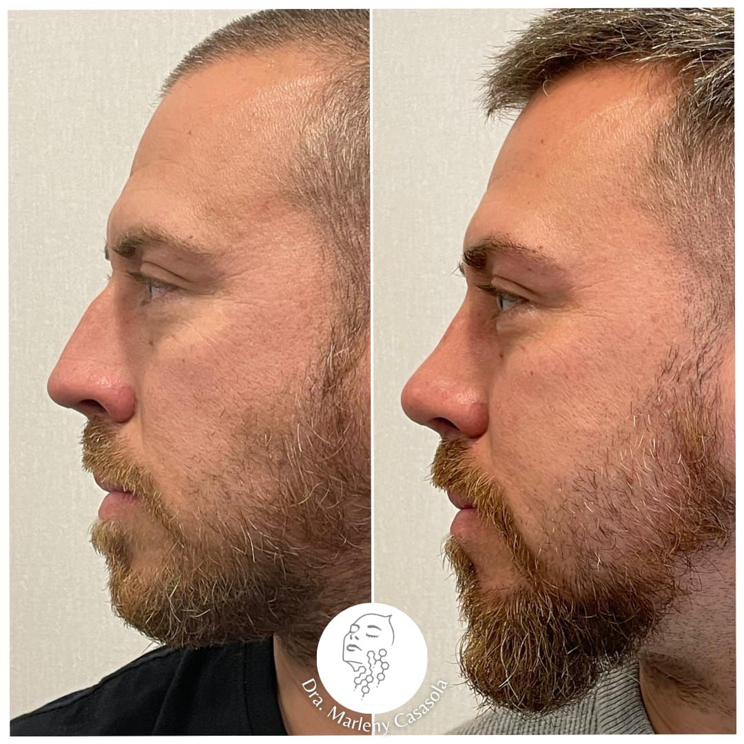 Sandra Marleny Casasola Girón-14