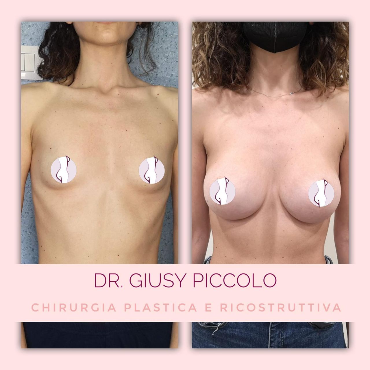 Giuseppina Piccolo-33