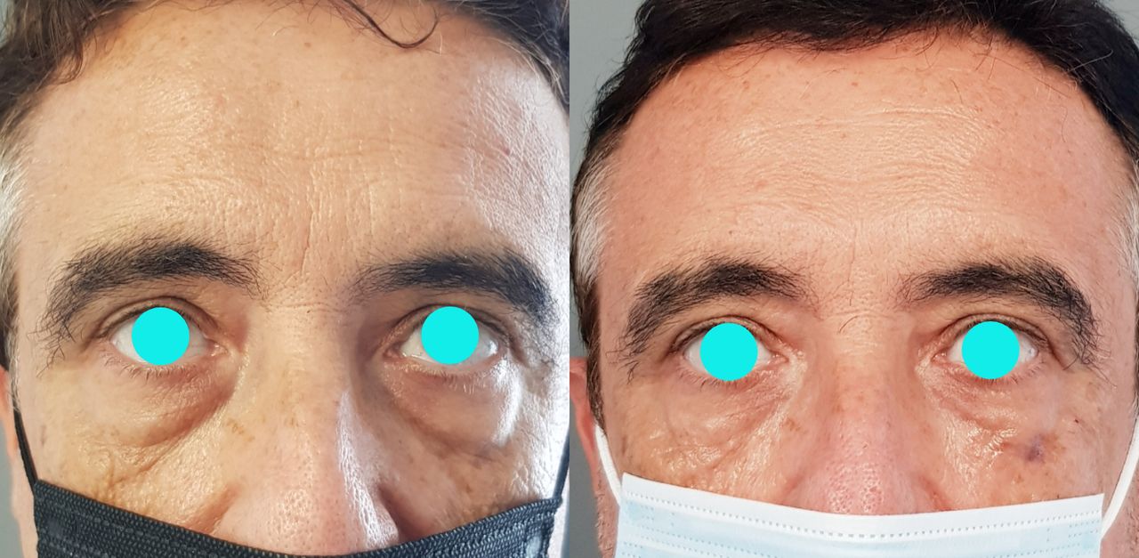 Rosalba Herrero Zerpa-125