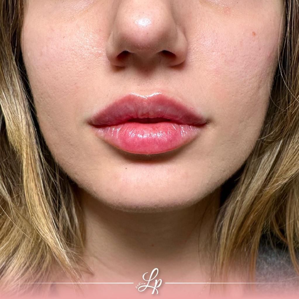 Ludovica Pollifrone-4