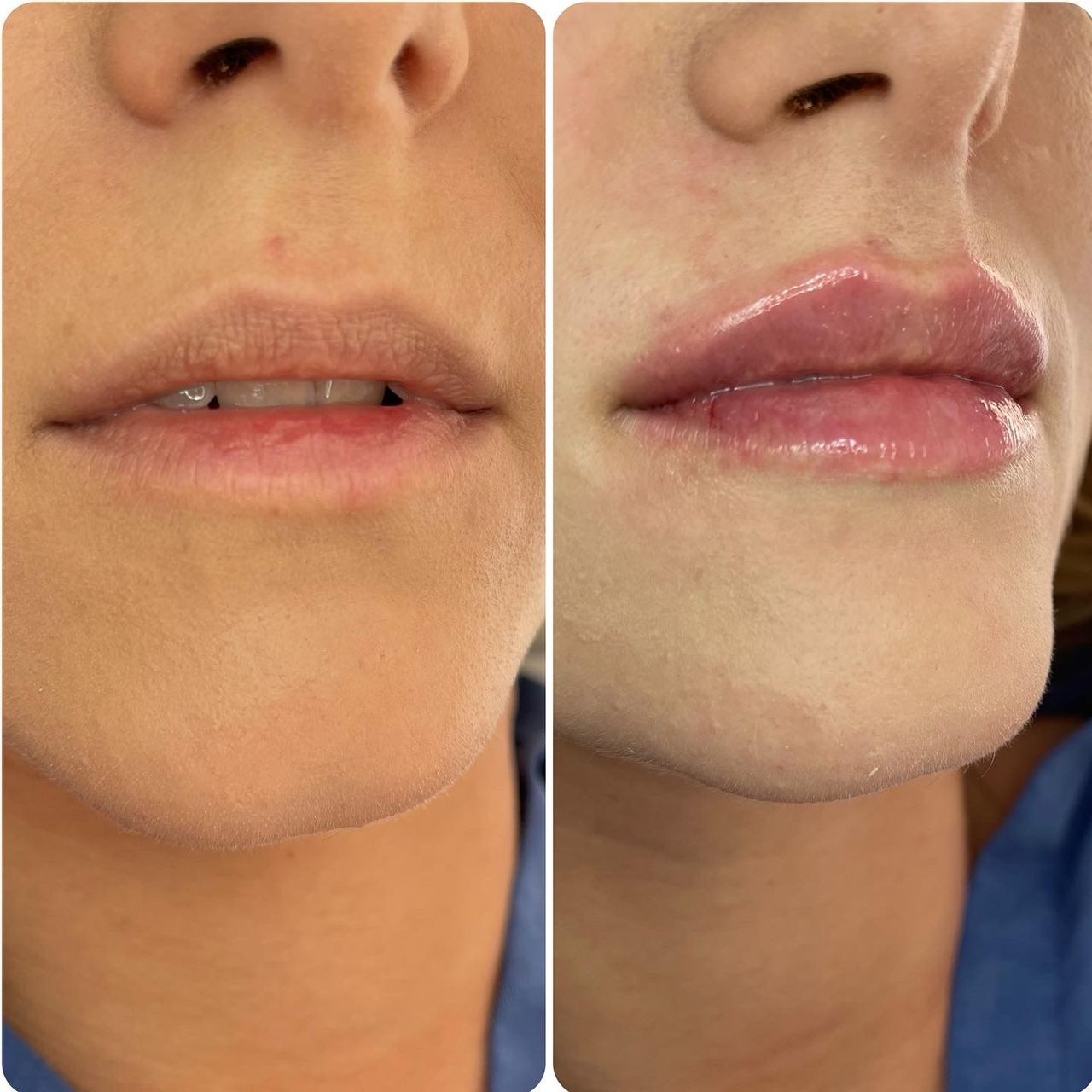 Aleksandra Cholewicka-14