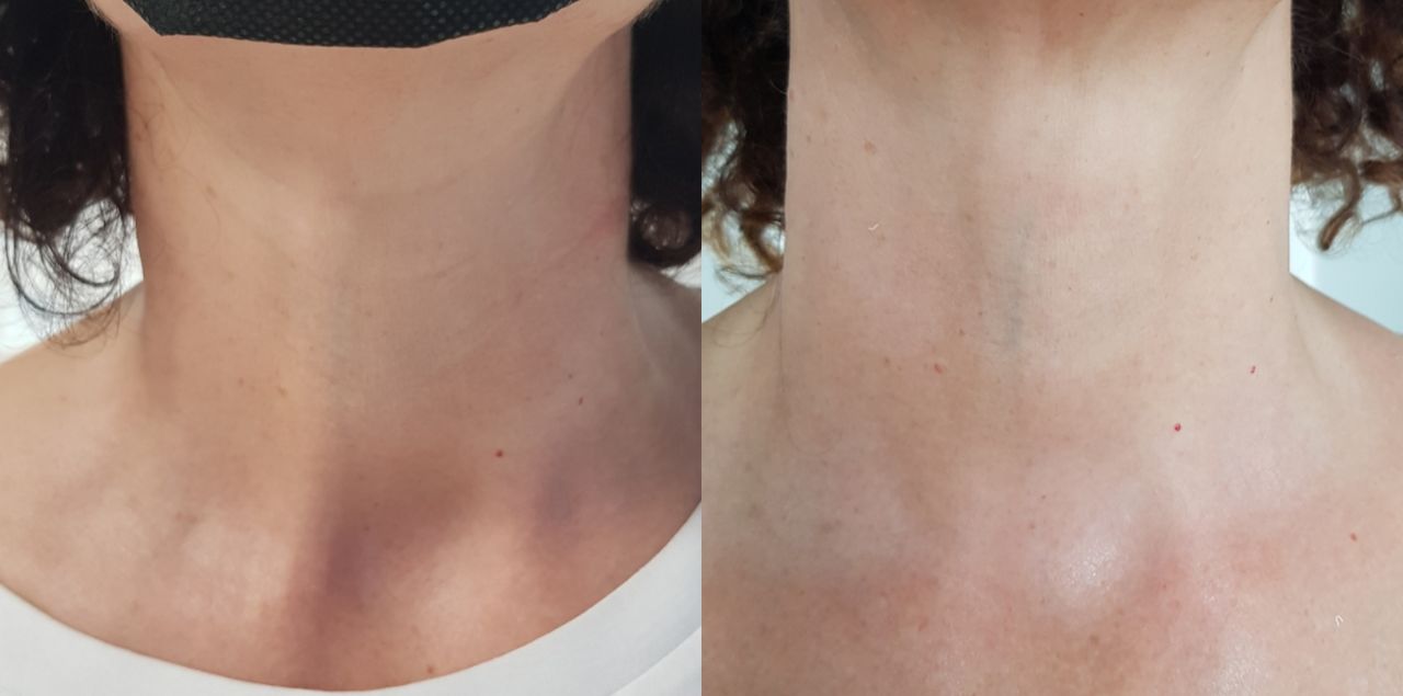 Rosalba Herrero Zerpa-161