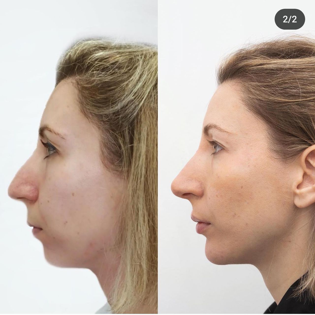 Raquel Moreno Pentinel-67