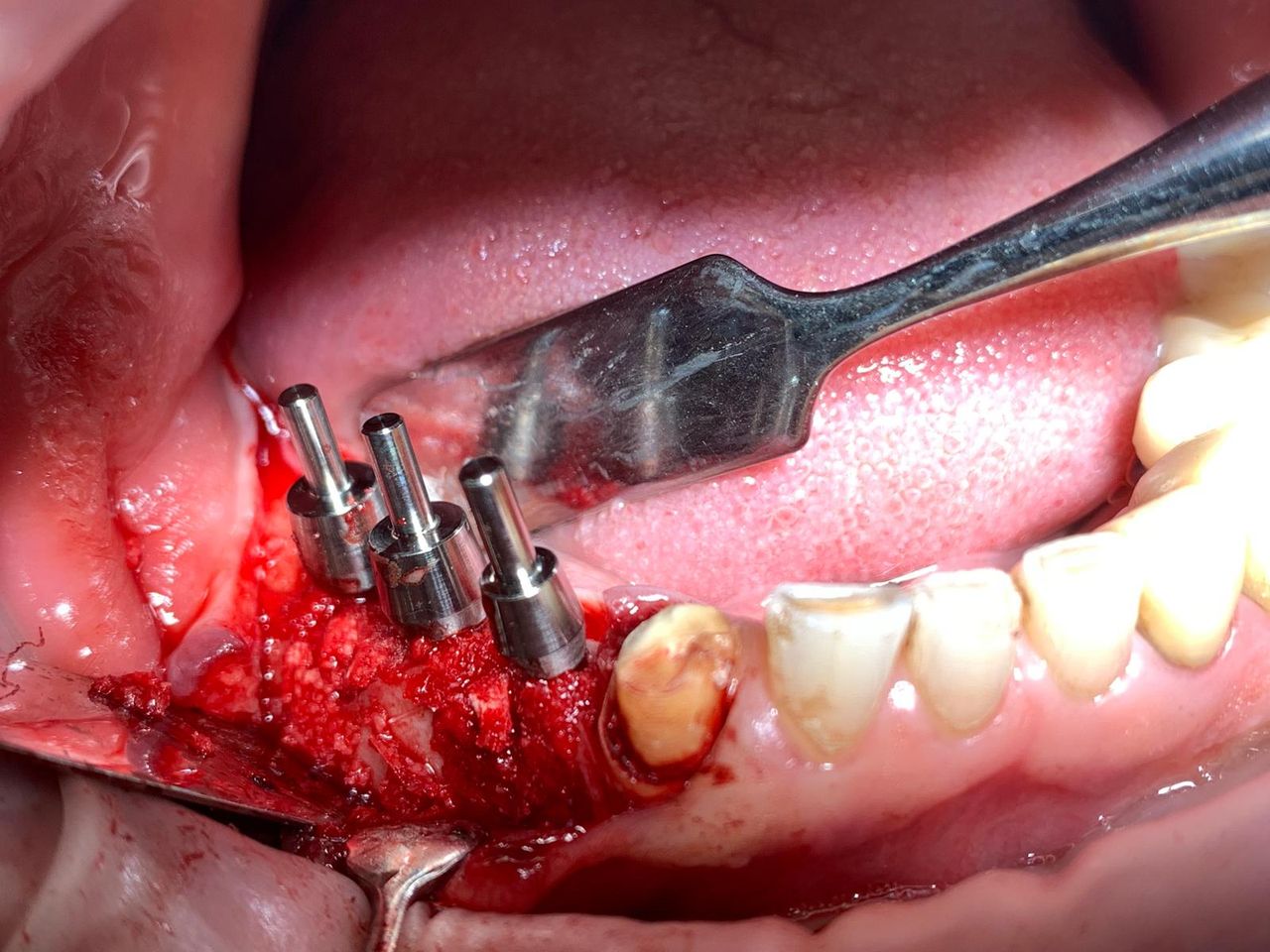 Stefano De Simone-44