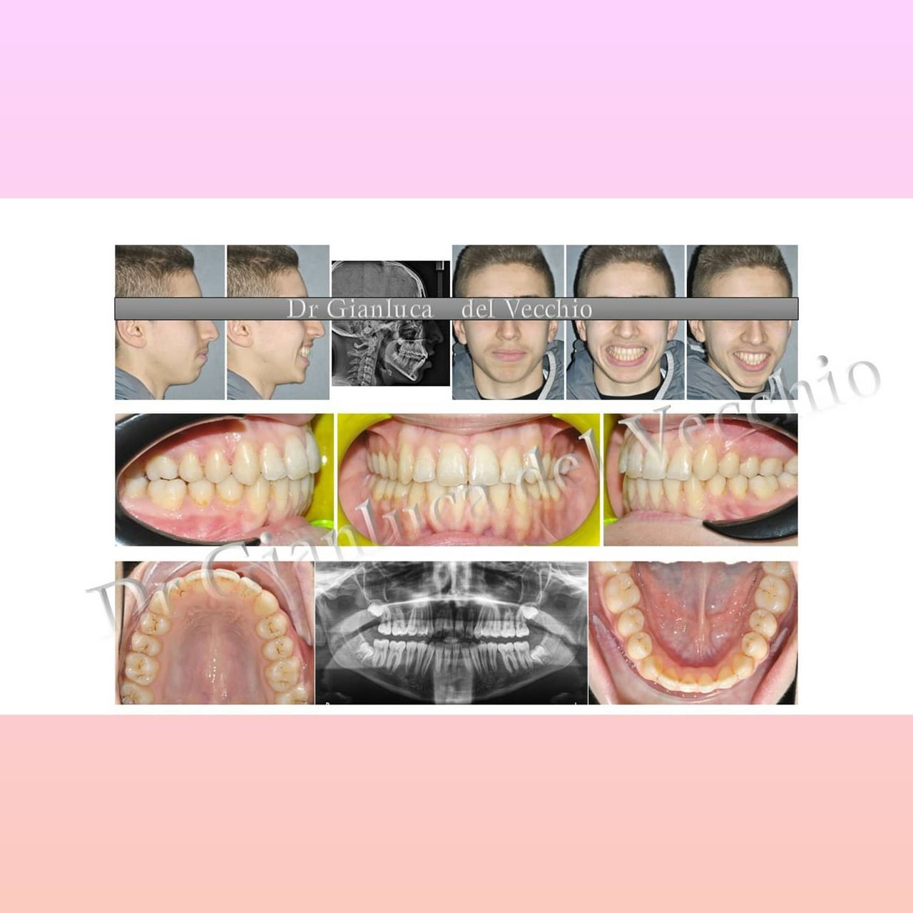 Gianluca Del Vecchio-66