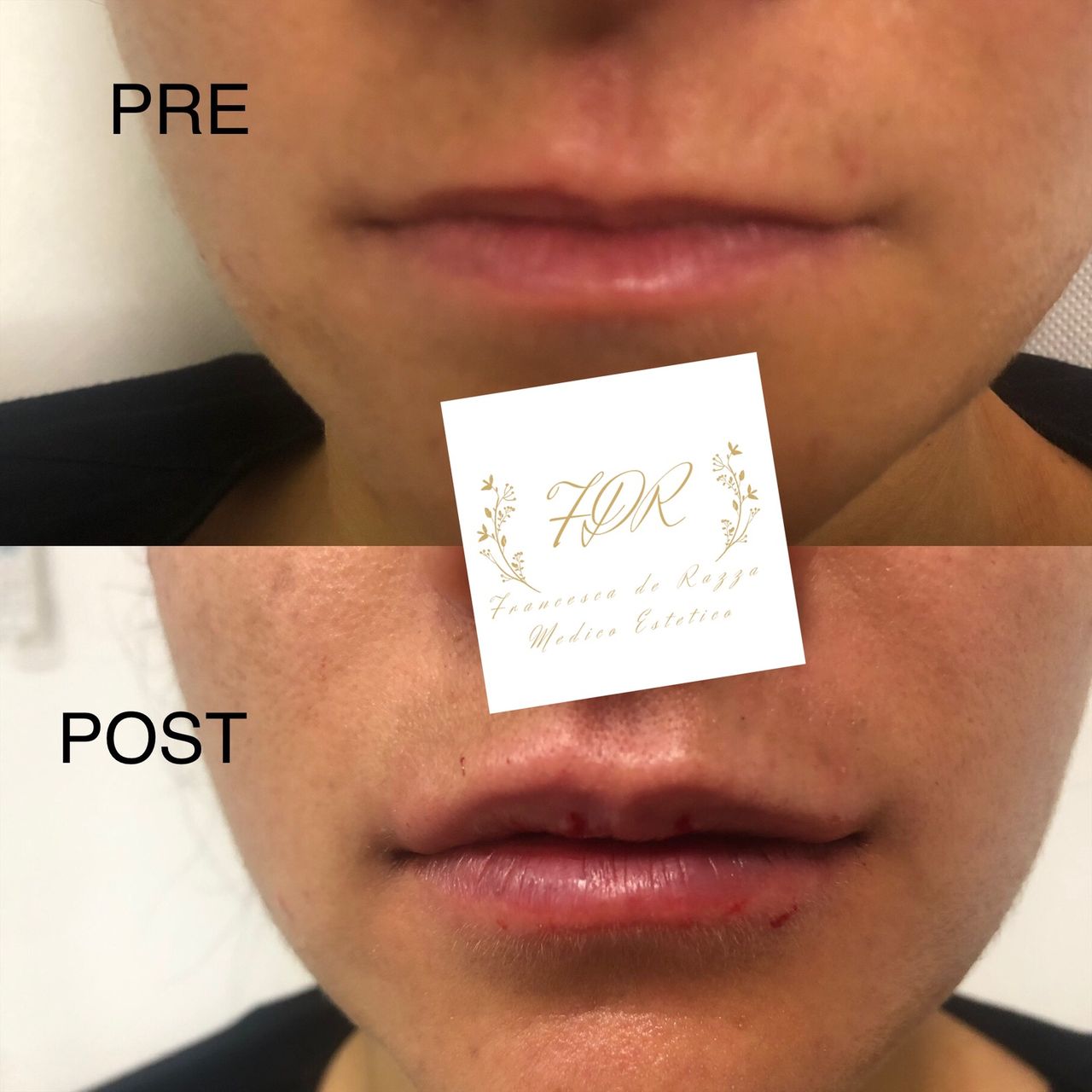 Francesca De Razza-27