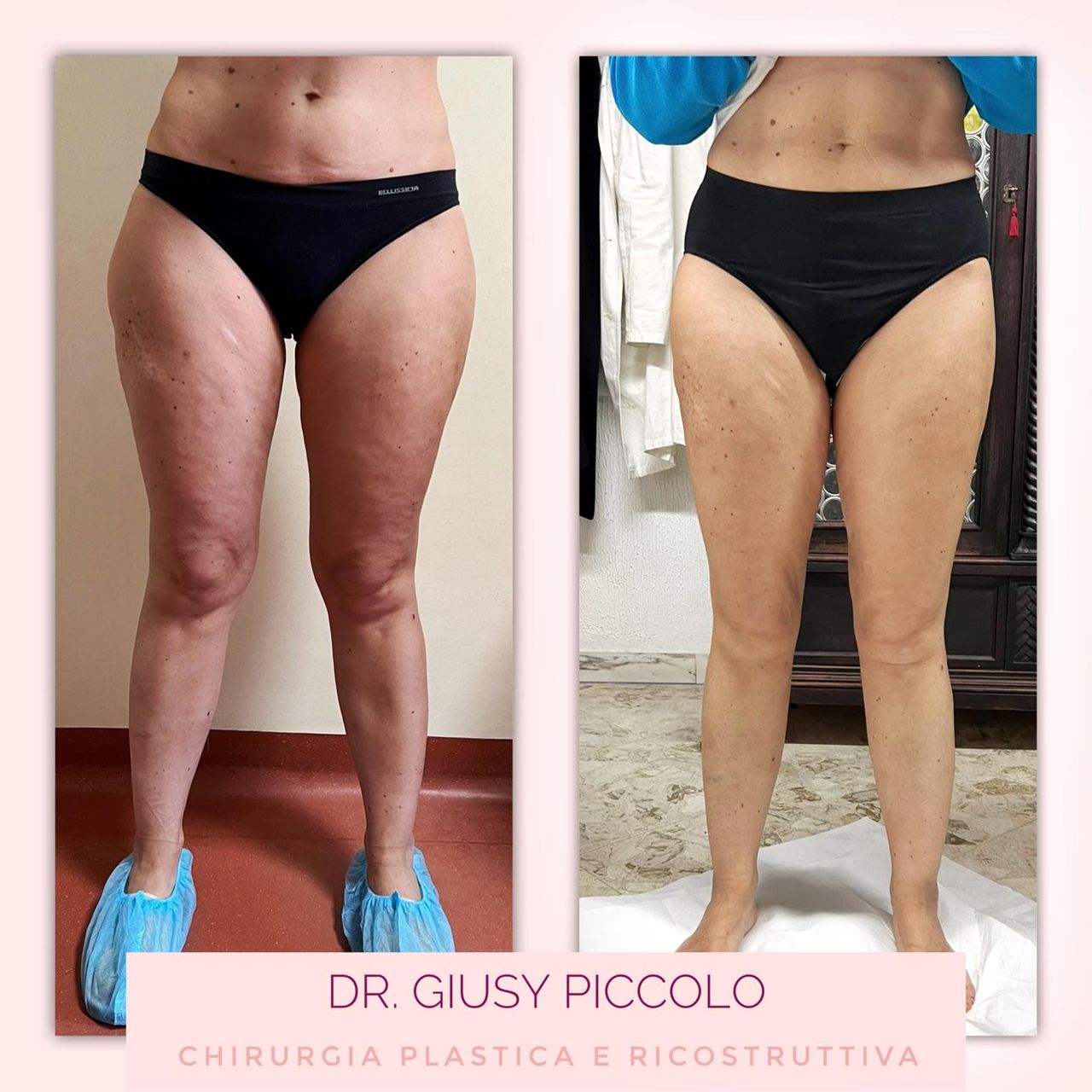 Giuseppina Piccolo-16