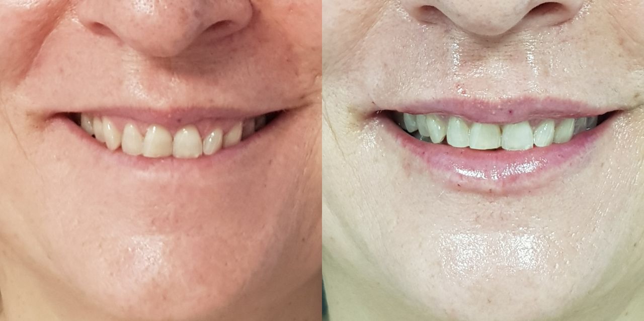 Rosalba Herrero Zerpa-54