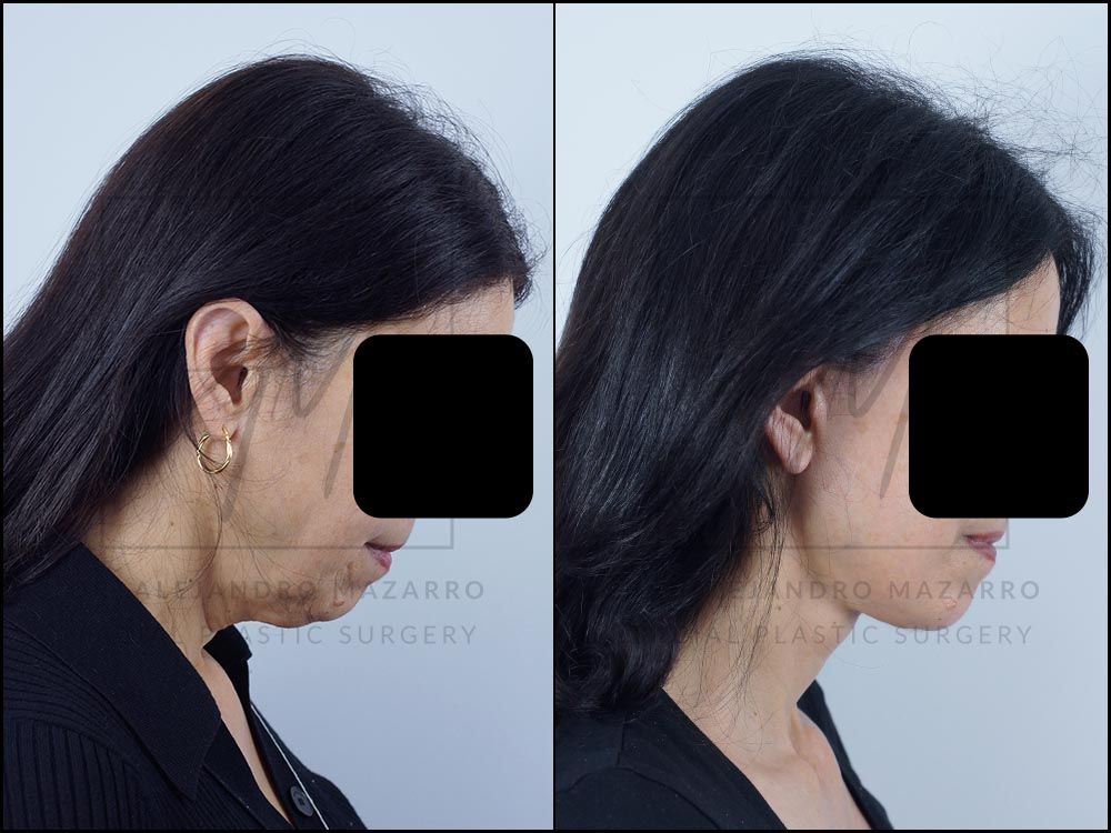 Alejandro Mazarro Campos-2