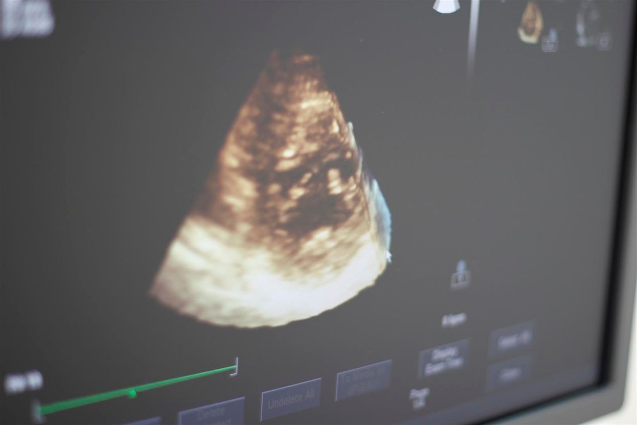 Katarzyna Wojnarska-6