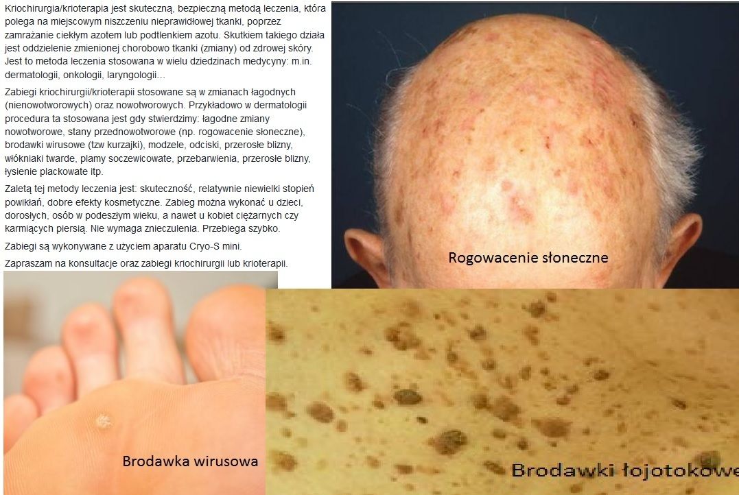 Zbigniew Pietrzak-15