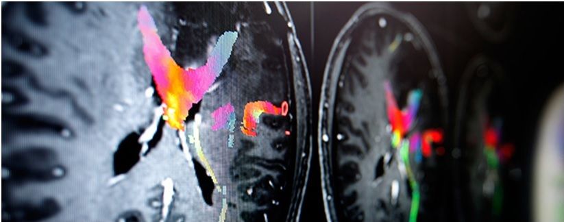 Alessandro Borderi-4