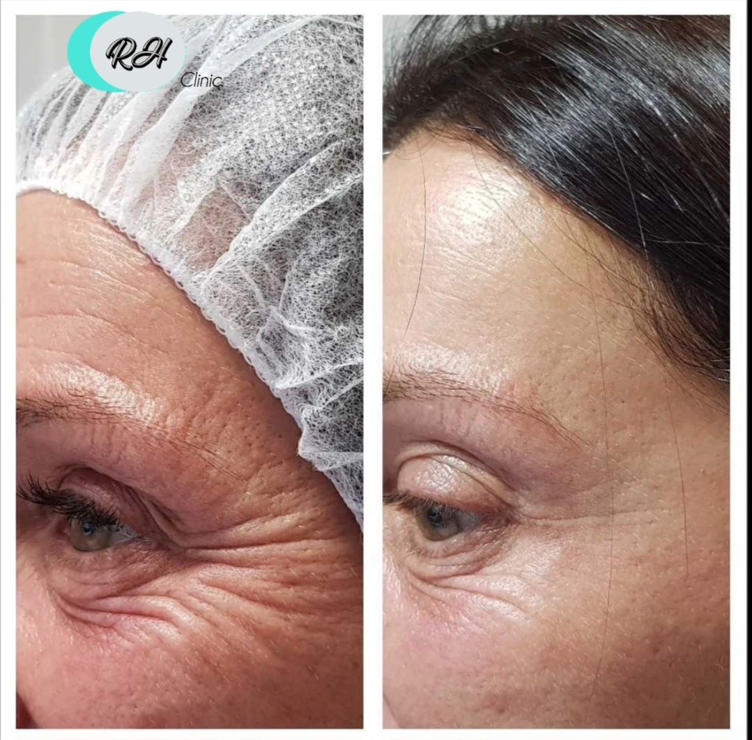 Rosalba Herrero Zerpa-545