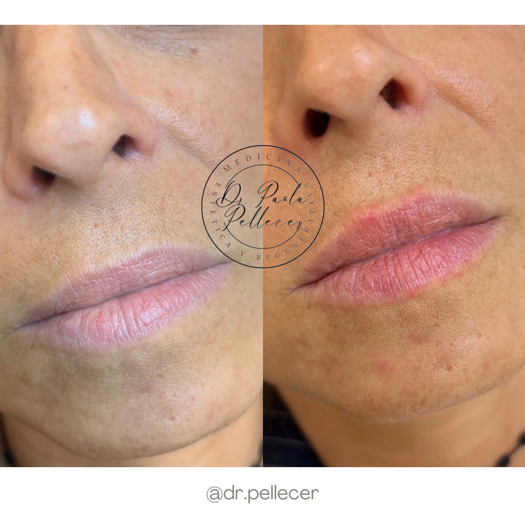 Liliana Paola Pellecer Ruiz-7