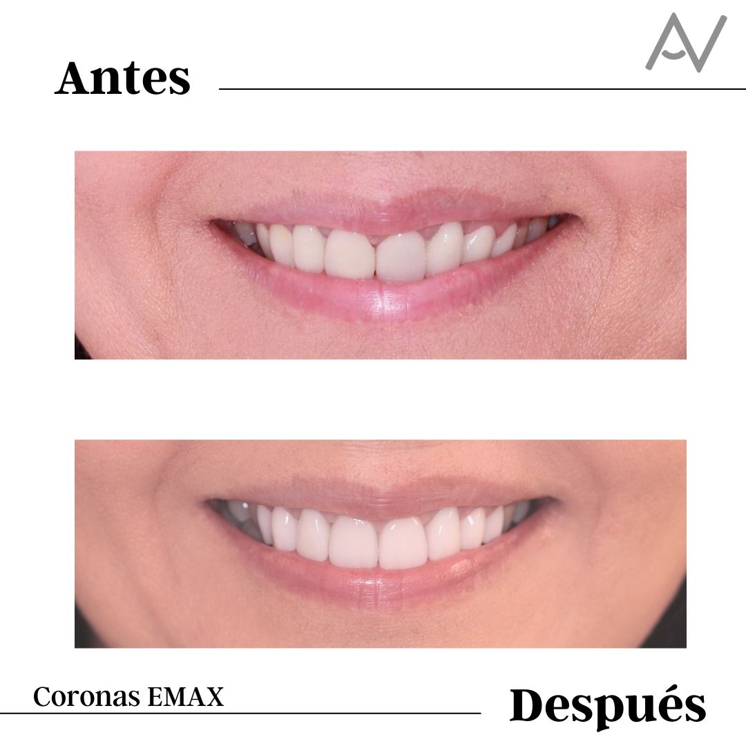 Antonia Aviles Lopez-40