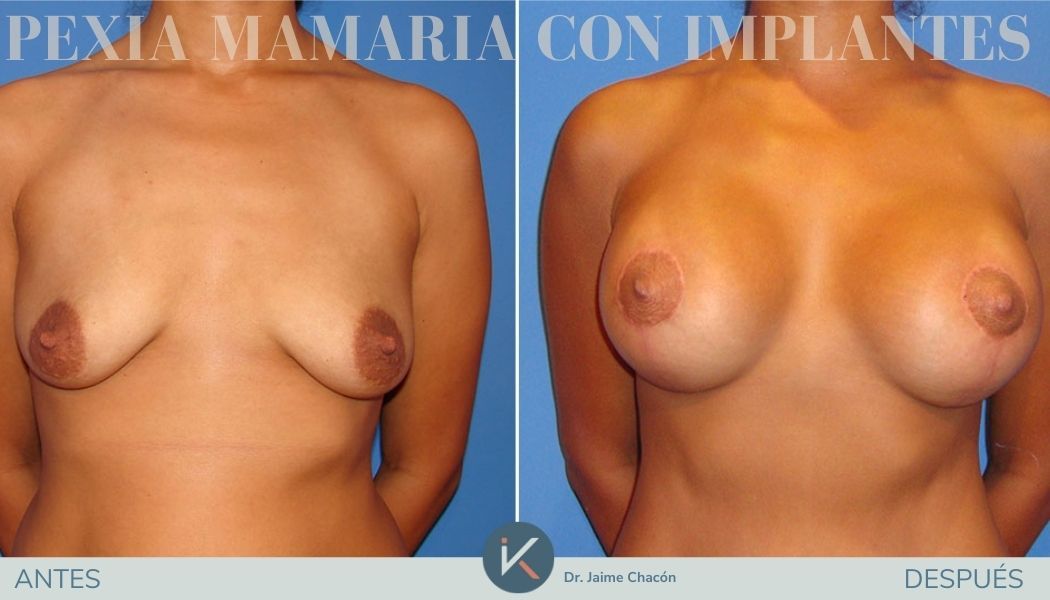 Jaime Eduardo Chacón Hernández-0