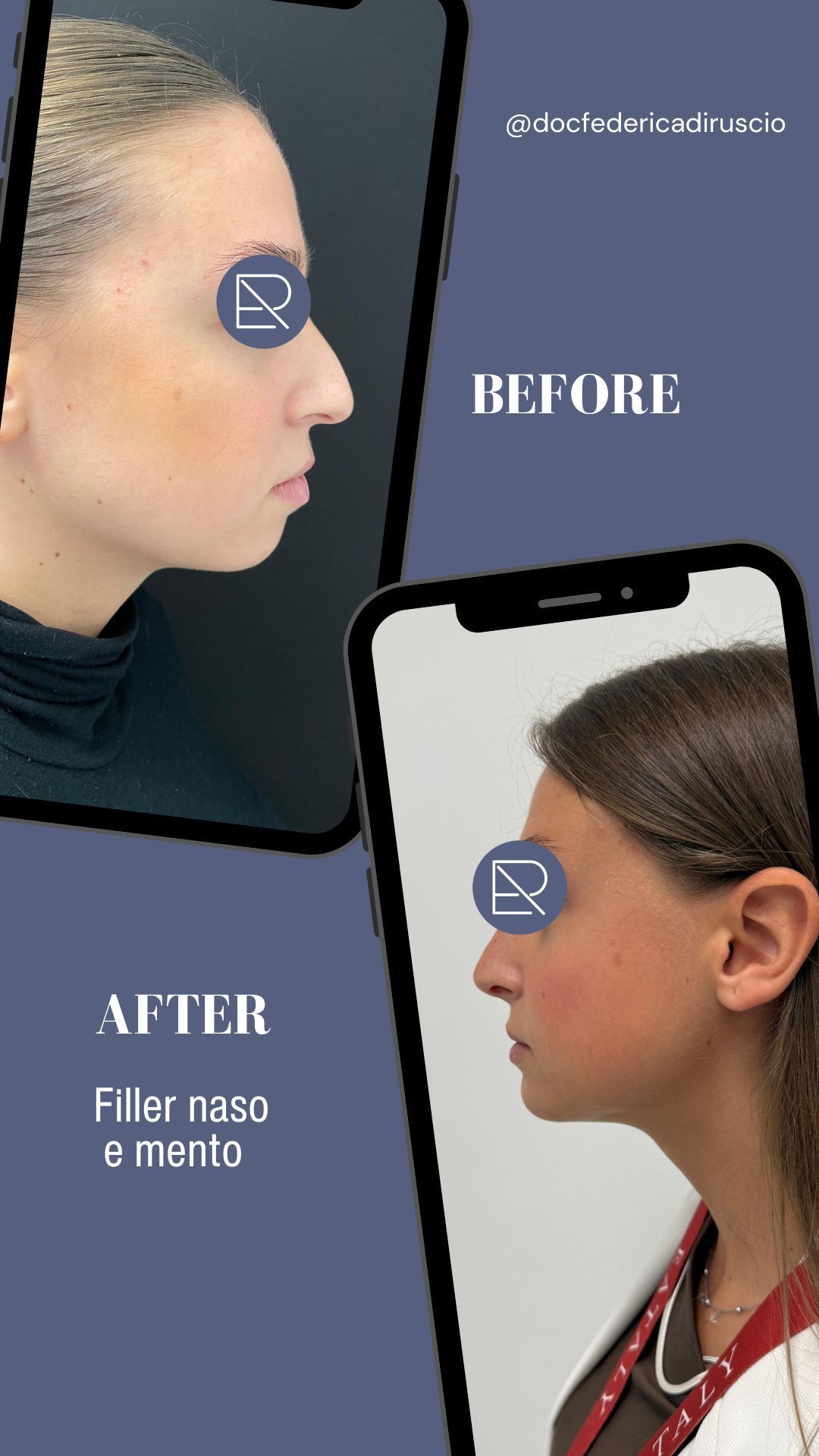 Federica Di Ruscio-1