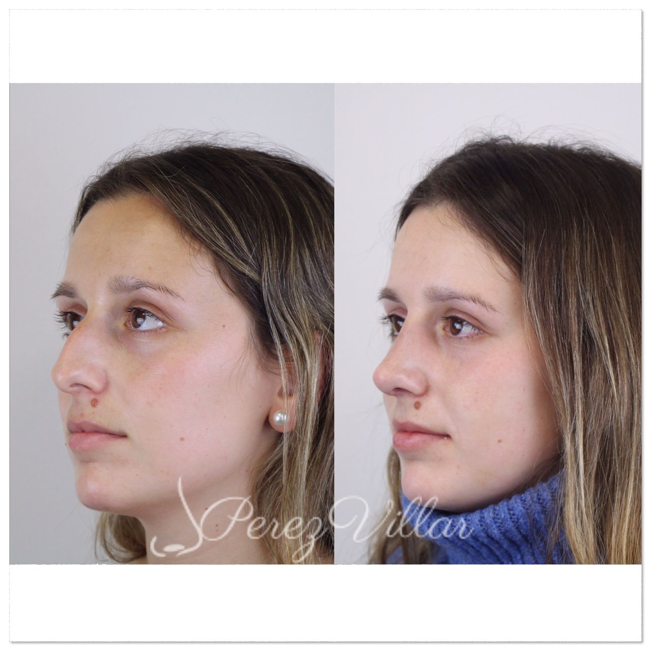 Alvaro Perez Villar-4