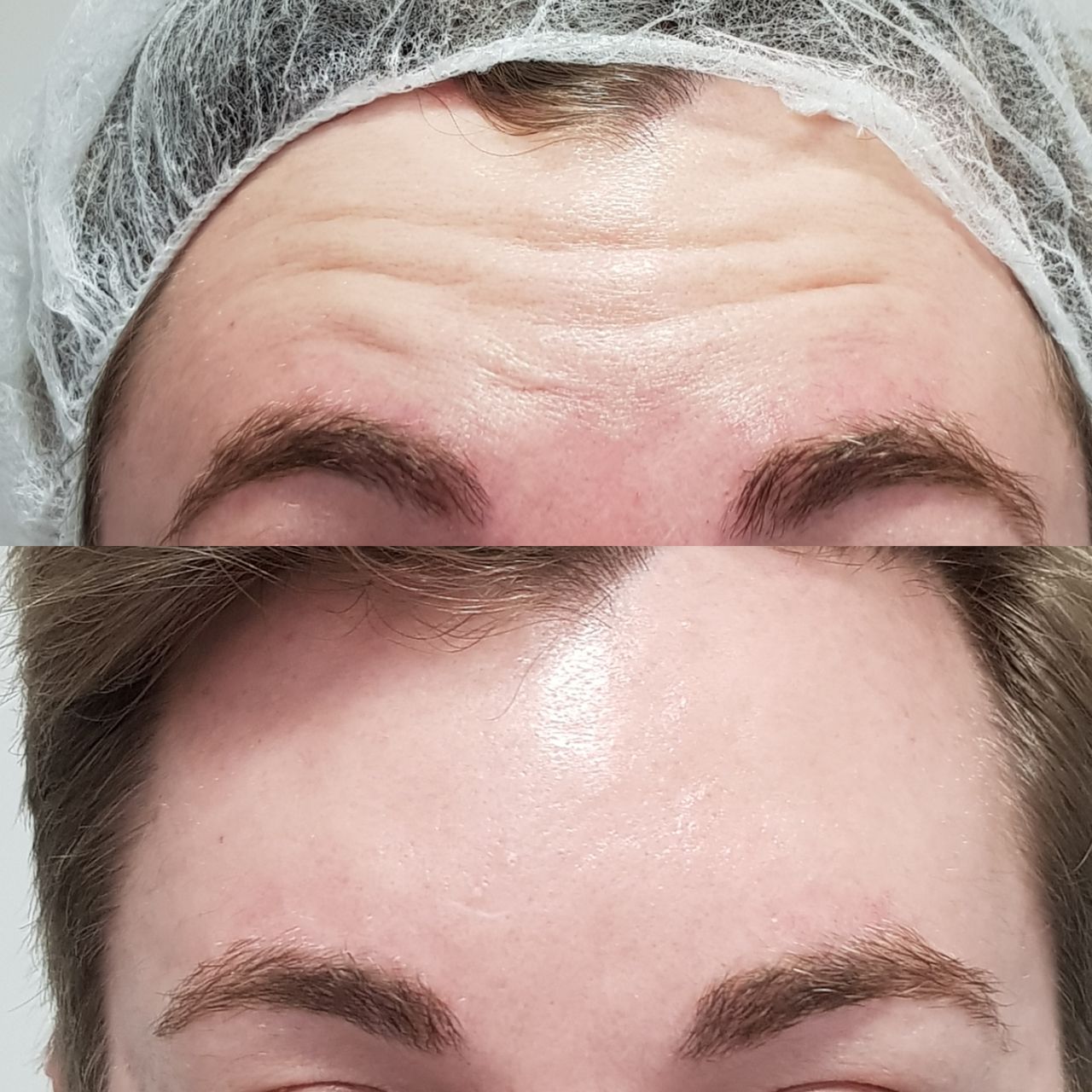 Rosalba Herrero Zerpa-302