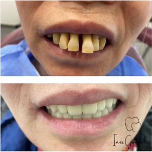 Inés Gonzalez Ordoño-7