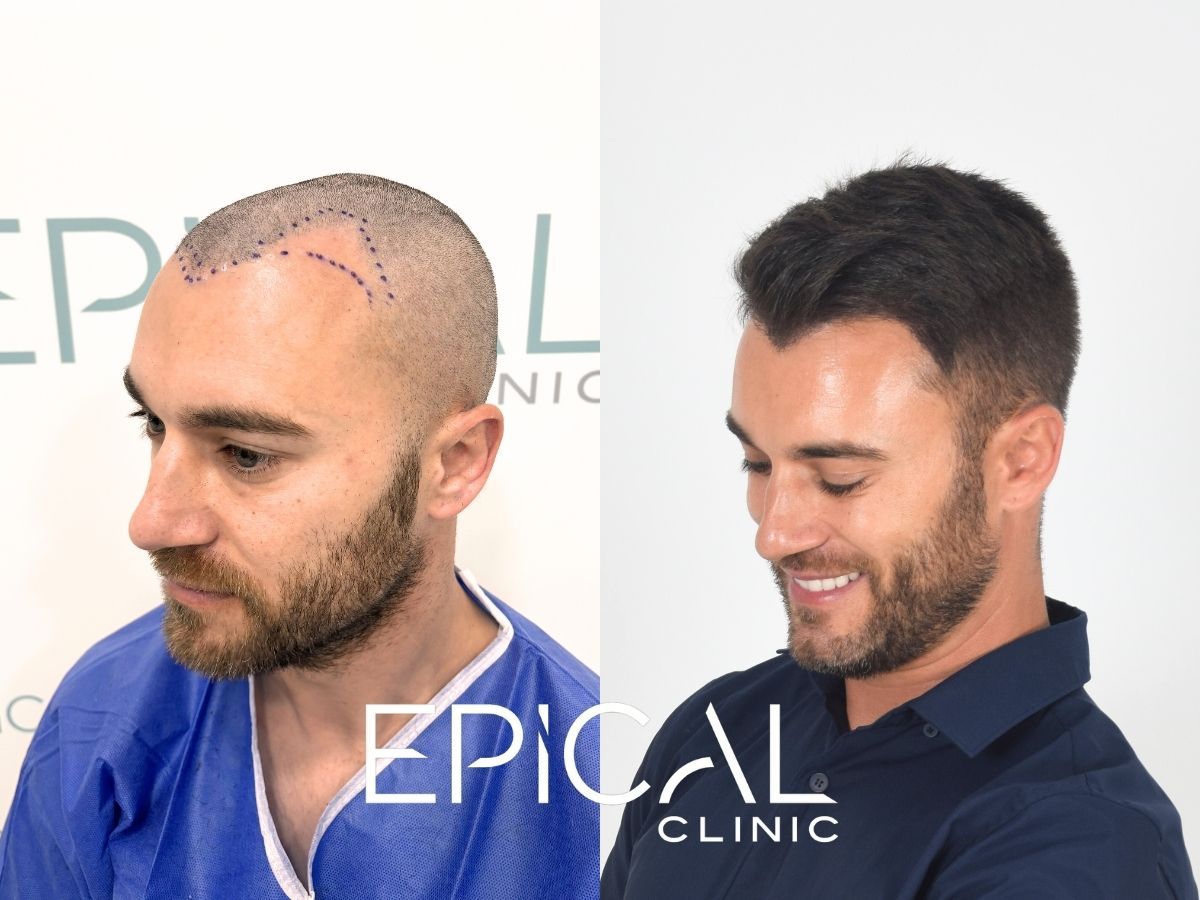 Juan Francisco Belén Montero-29