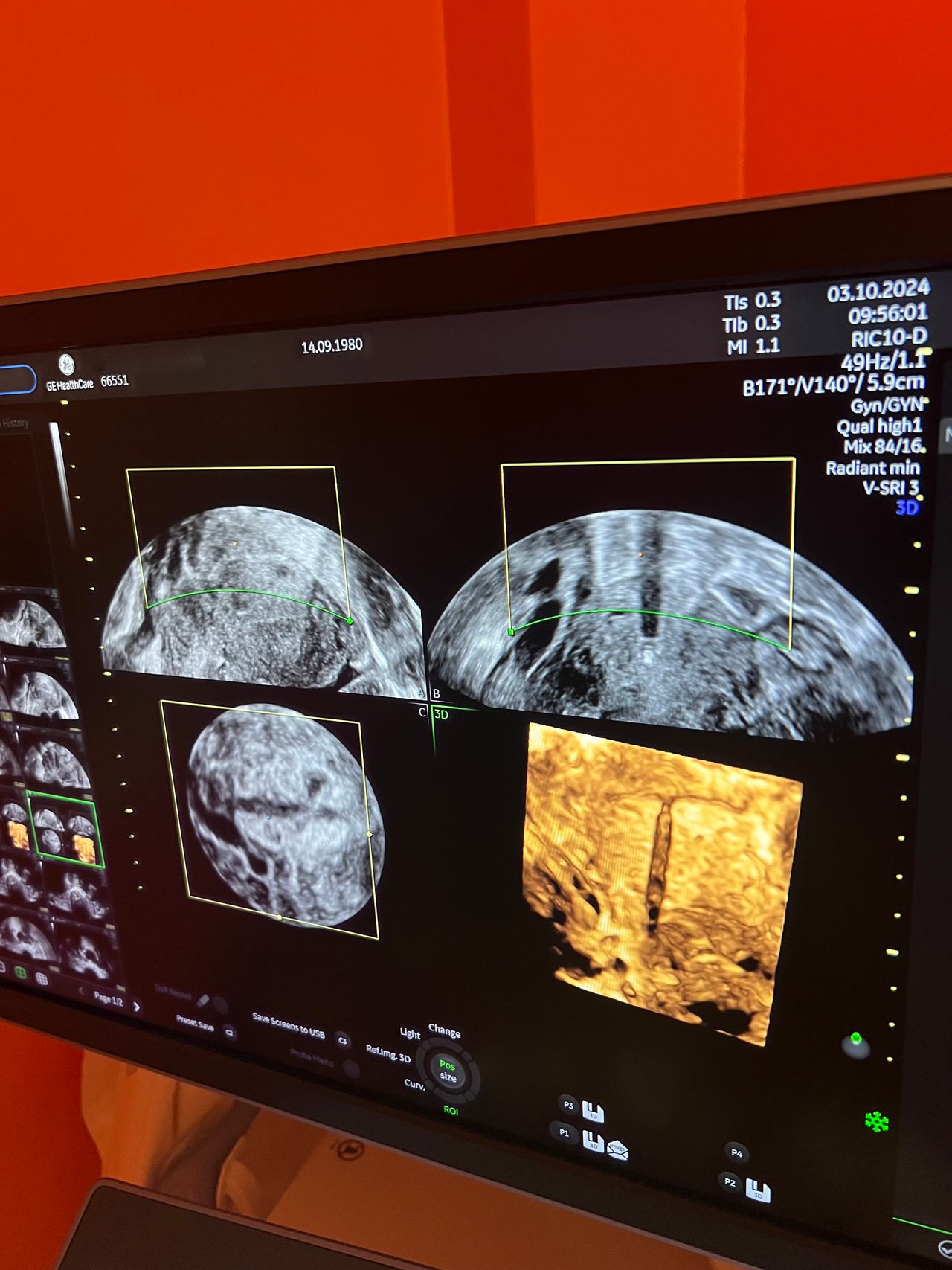 Antonietta Borzacchelli-1