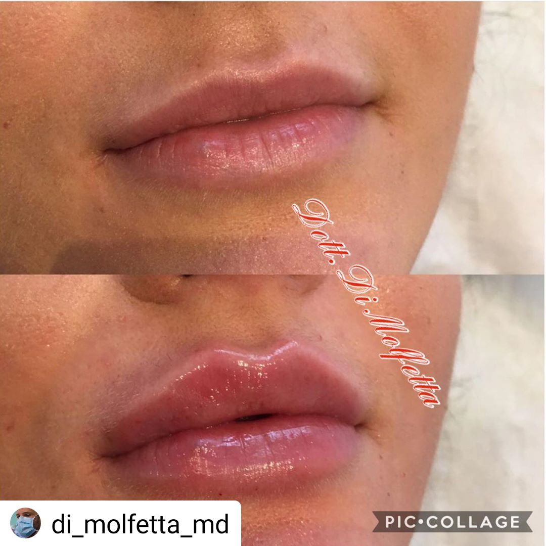 Pasquale Di Molfetta-15