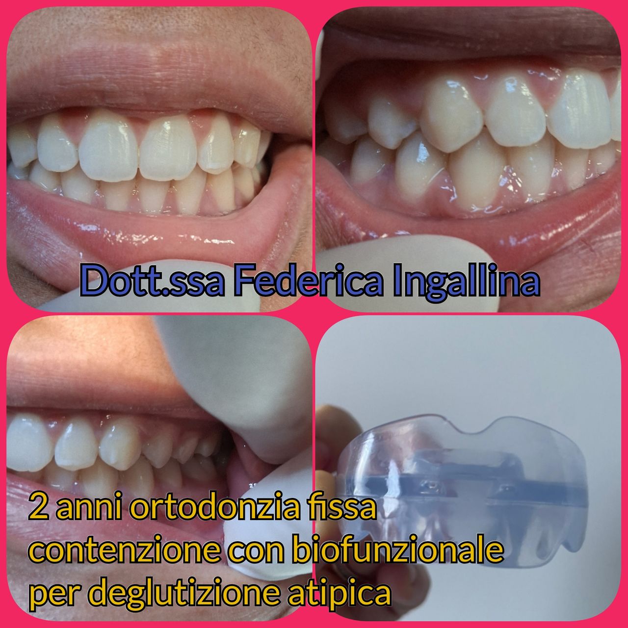 Federica Ingallina-25