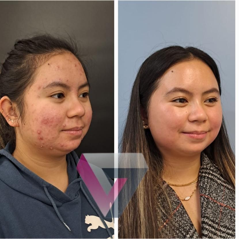 Victoria Trasmonte-109