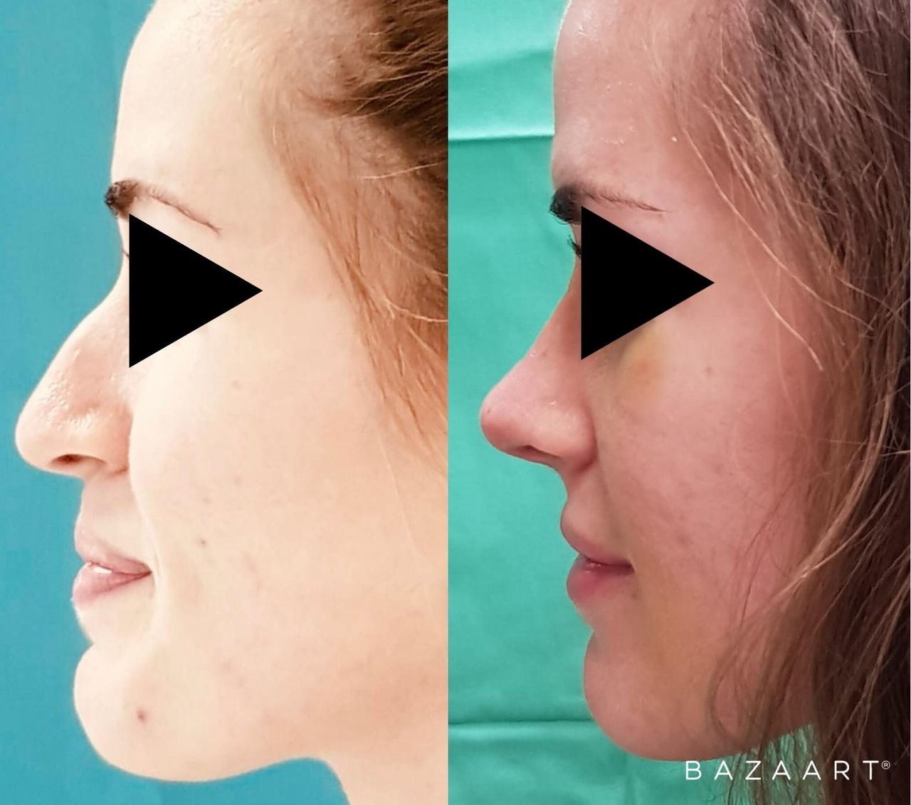 Enrique Bonanad Fernandez-11