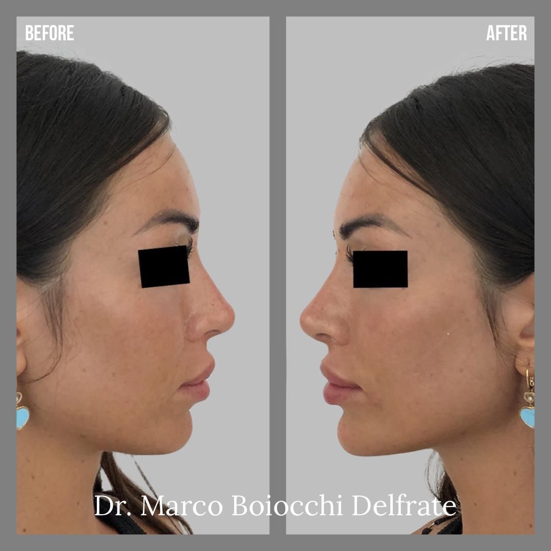 Marco Boiocchi Delfrate-0