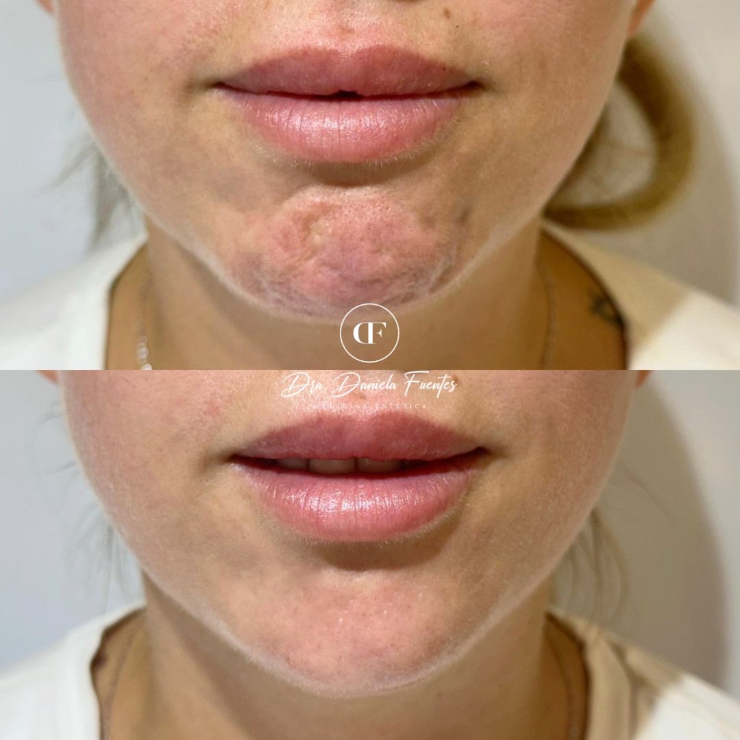 Daniela Fuentes Ortiz-18