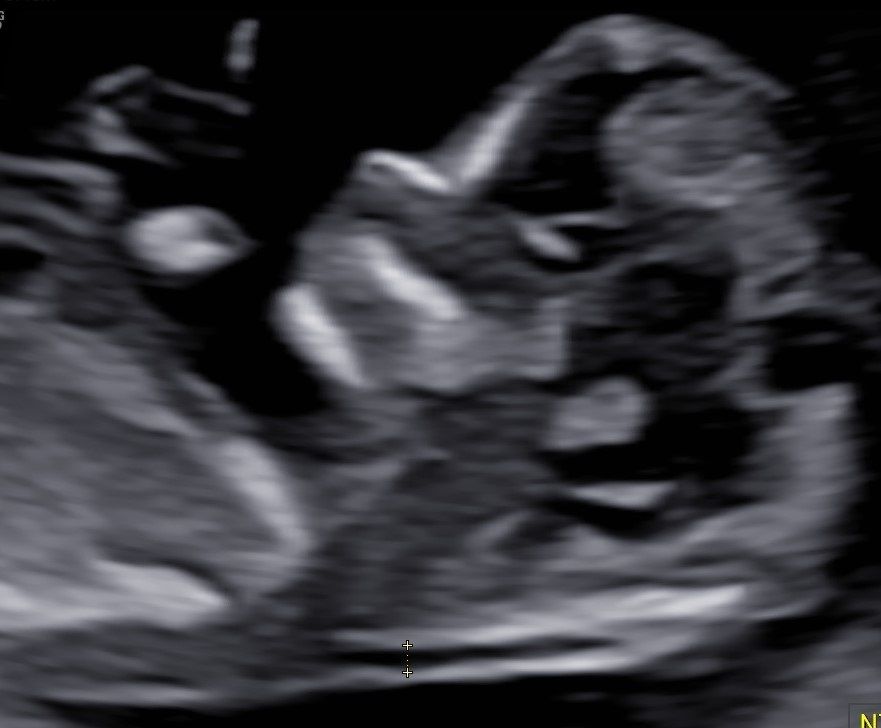 Valentina Conserva-8