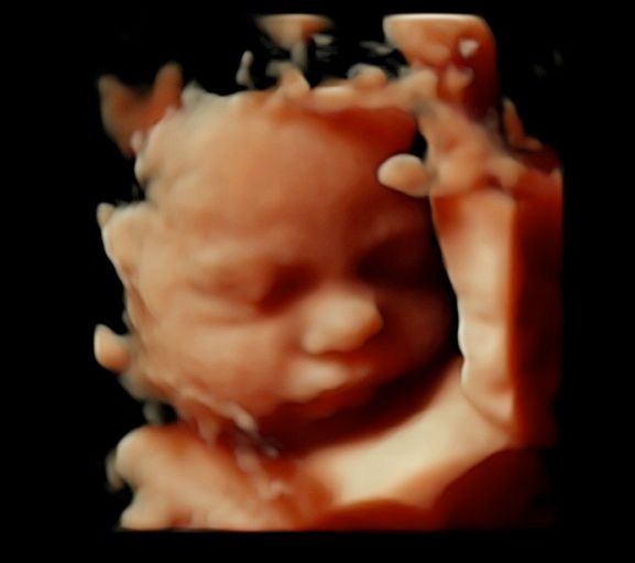 Tommaso Incandela-39