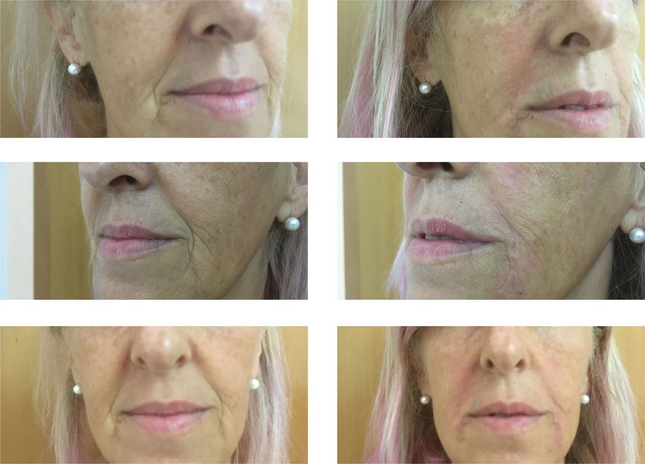 Virginia Cristina Rapisarda-47