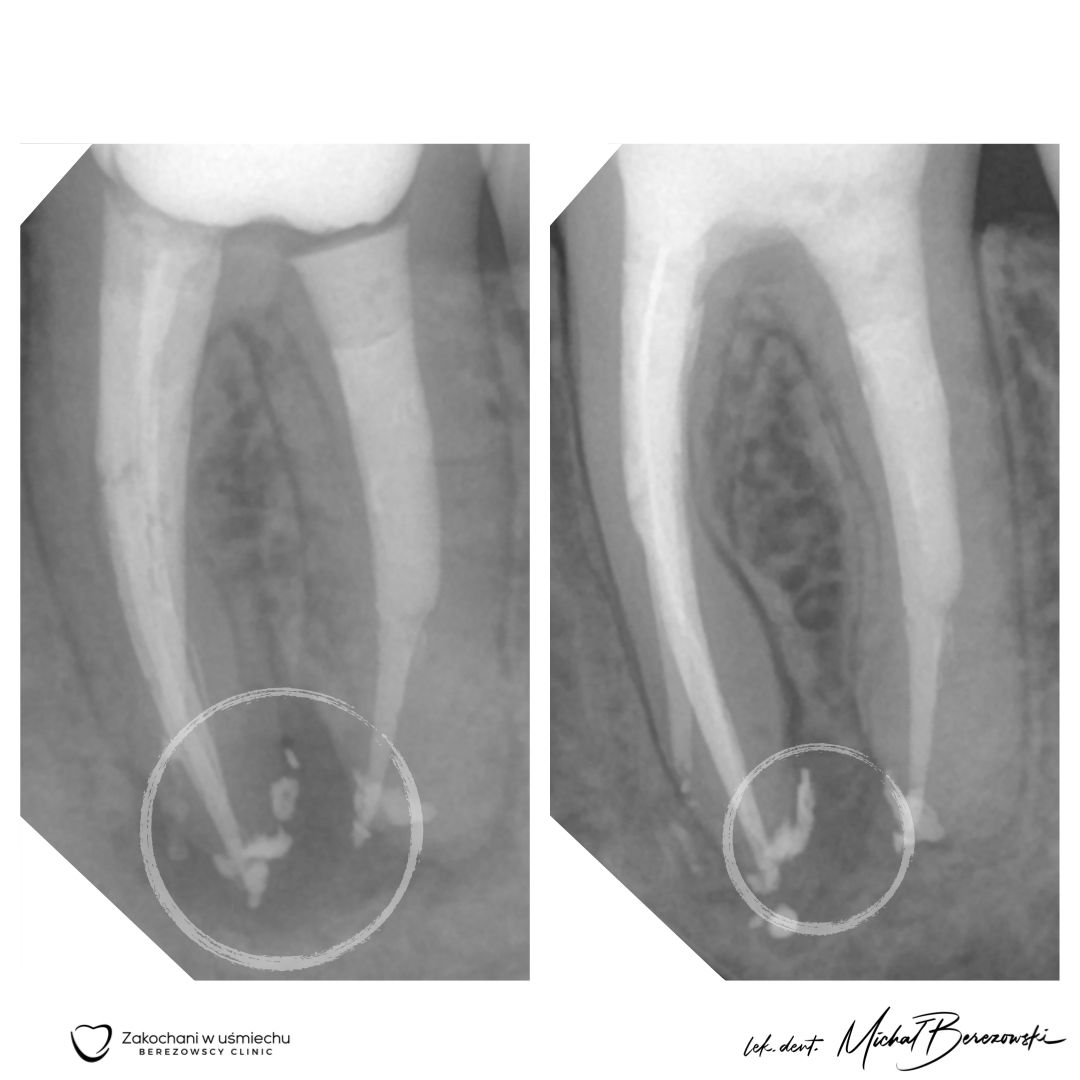 Michał Berezowski-7