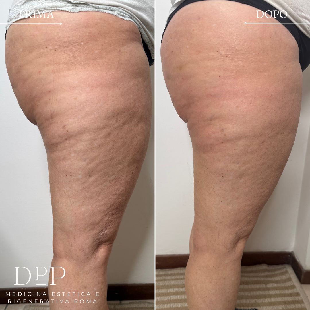 Davide Prosperi Porta-9