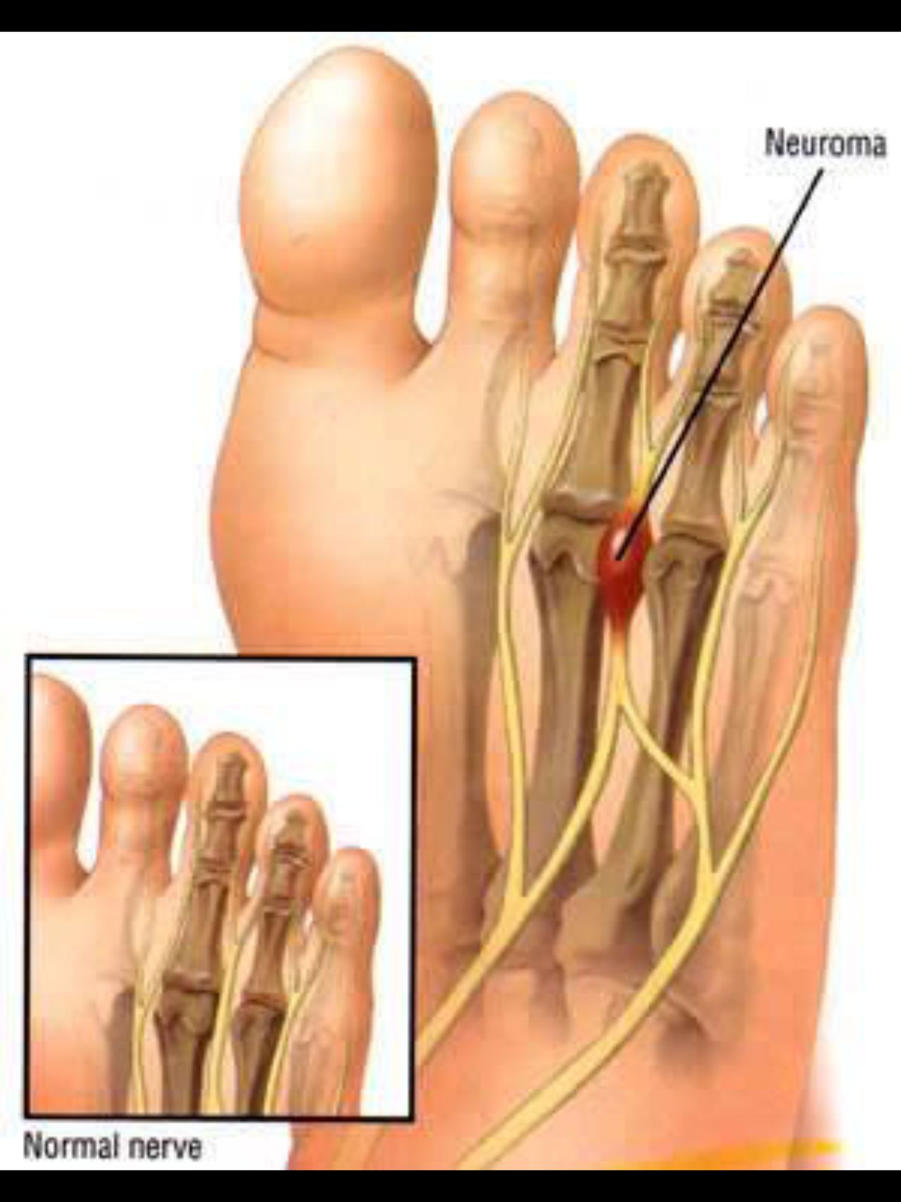 Giuseppe Lombardo-38