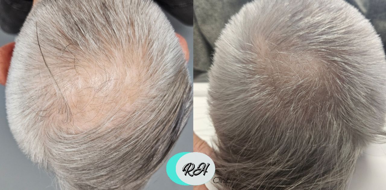 Rosalba Herrero Zerpa-587