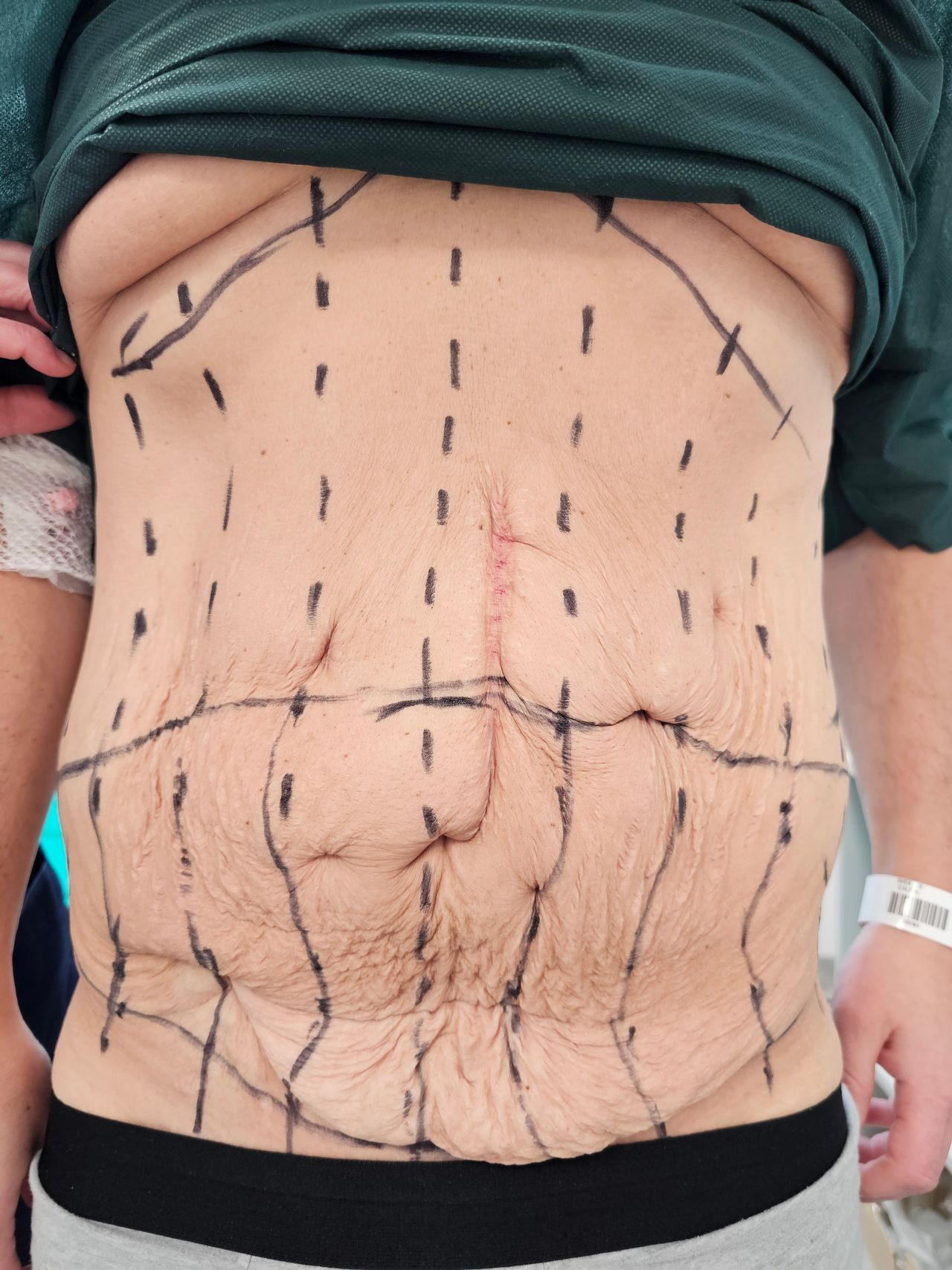 Bartłomiej  Staśkiewicz -6