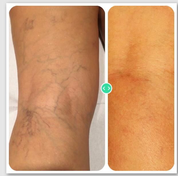 Arnaldo Strazzaboschi-9